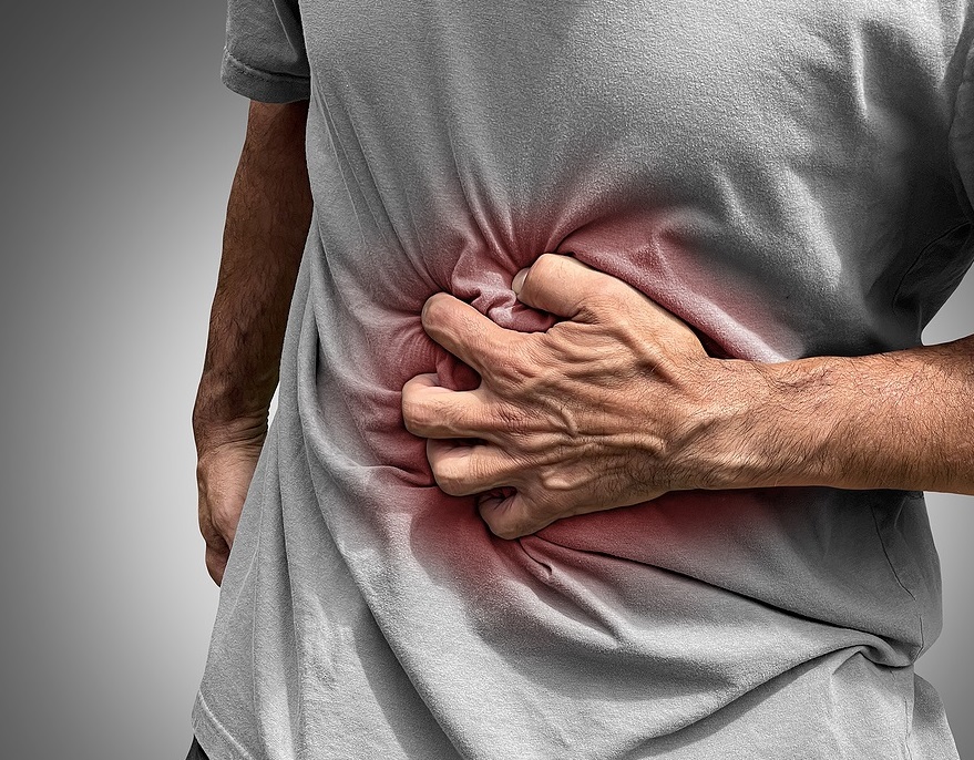 Case study on Crohn’s disease